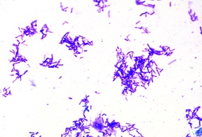 Mikropräparat - Proteus vulgaris. Fäulnisbakterien. Ausstrich