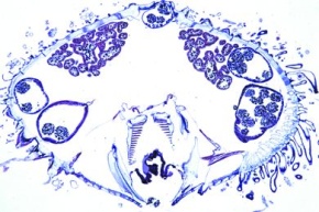Mikropräparat - Echinus, Seeigel, junges Tier, sagittal