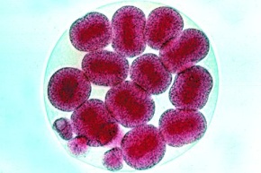 Mikropräparat - Psammechinus, Zweiunddreißig-Zellen-Stadium