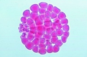 Mikropräparat - Psammechinus, Morula
