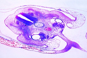 Mikropräparat - Huhn Embryo 4-5 Tage. Querschnitt durch die Kopfregion