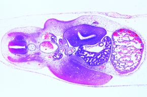 Mikropräparat - Huhn Embryo 4-5 Tage. Querschnitt durch die Herz-Augenregion