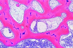 Mikropräparat - Rotes Knochenmark, embryonaler Röhrenknochen vom Mensch, quer