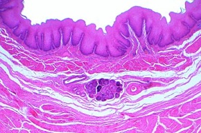 Mikropräparat - Speiseröhre (Oesophagus), quer *