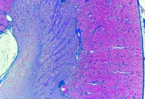 Mikropräparat - Niere des Menschen, Rinde und Mark, quer