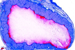 Mikropräparat - Eierstock, Gelbkörper (Corpus luteum), quer