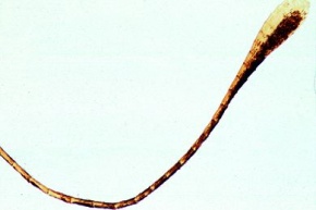 Mikropräparat - Pieris brassicae, Kohlweißling, keulenförmiger Fühler