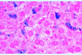 Mikropräparat - Leber, Färbung der Kupfferschen Sternzellen, quer
