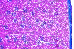 Mikropräparat - Niere der Katze, quer. Rinde mit Malpighischen Körperchen und Mark mit Tubuli