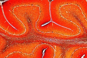 Mikropräparat - Kleinhirn, quer, Färbung nach Ramon y Cajal