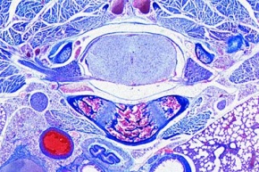 Mikropräparat - Rückenmark der Ratte, quer mit Wirbelkörper