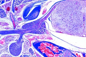 Mikropräparat - Rückenmark mit Ganglien, dorsalen und ventralen Nervenwurzeln, quer