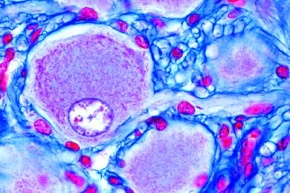 Mikropräparat - Ganglion semilunare (Gasseri), quer, Unipolare Nervenzellen *