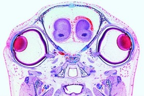 Mikropräparat - Augenanlagen, Kopf vom Mäuseembryo, quer