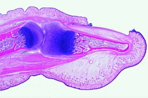 Mikropräparat - Fingerspitze vom menschlichen Fetus mit Nagelanlage, sagittal