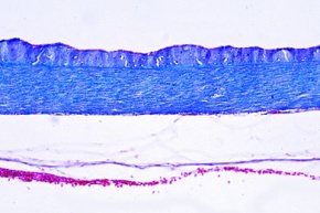 Mikropräparat - Cyprinus, Schwimmblase quer