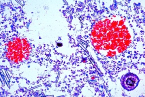 Mikropräparat - Spongilla, Süßwasserschwamm (Kieselschwamm)