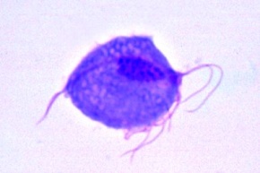 Mikropräparat - Trichomonas vaginalis, Ausstrich
