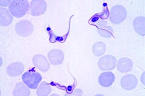 Mikropräparat - Trypanosoma cruzi (Schizotrypanum), Erreger der Chagaskrankheit des Menschen. Blutausstrich mit Trypanosomen