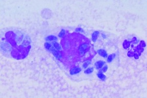 Mikropräparat - Toxoplasma gondii, Cysten im Gehirn. Schnitt