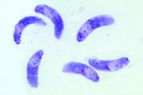 Mikropräparat - Toxoplasma gondii, Erreger der Toxoplasmose. Gewebeausstrich