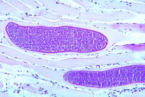 Mikropräparat - Sarcocystis tenella, Schnitt durch infiziertes Muskelgewebe
