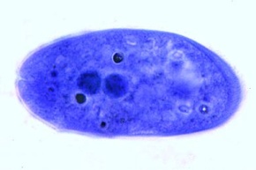 Mikropräparat - Balantidium coli, Darmparasit des Menschen, Ausstrich mit vegetativen Formen