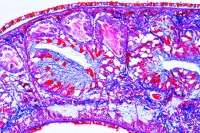 Mikropräparat - Planaria, sagittaler Längsschnitt durch ganzes Tier