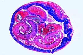 Mikropräparat - Schistosoma mansoni, Männchen und Weibchen, quer