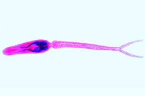 Mikropräparat - Schistosoma mansoni, Furcocercarien (Gabelschwanzlarven), total
