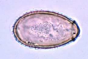 Mikropräparat - Clonorchis sinensis, Eier, total