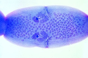 Mikropräparat - Dipylidium caninum, gravide Proglottiden, total